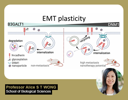 DNM1 as a Key Regulator in Ovarian Cancer Metastasis