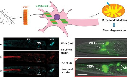 HKU biologists identified bacterial proteins that promote neurodegeneration, shedding light on new ways to prevent or slow down neurodegenerative diseases