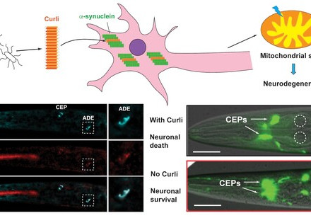 HKU biologists identified bacterial proteins that promote neurodegeneration, shedding light on new ways to prevent or slow down neurodegenerative diseases