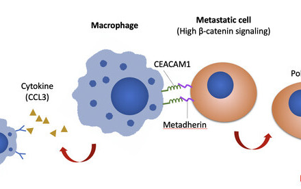 HKU Biologists Reveal a Novel Macrophages-mediated Mechanism that Promotes Peritoneal Metastasis of Ovarian Cancer,  Providing Important Insights into Its Therapeutic Strategy