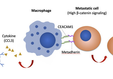 HKU Biologists Reveal a Novel Macrophages-mediated Mechanism that Promotes Peritoneal Metastasis of Ovarian Cancer,  Providing Important Insights into Its Therapeutic Strategy