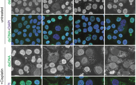 HKU Biologists Reveal a Molecular Scissor that Cuts Chromatin Bridge and Prevents DNA Damages and Autoimmunity