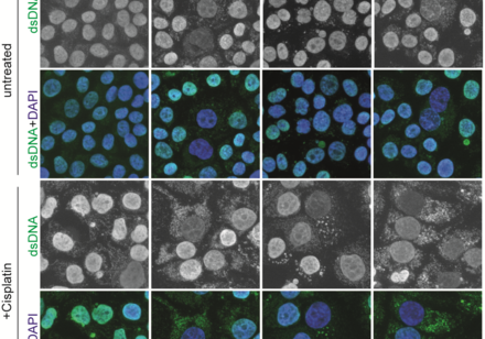 HKU Biologists Reveal a Molecular Scissor that Cuts Chromatin Bridge and Prevents DNA Damages and Autoimmunity