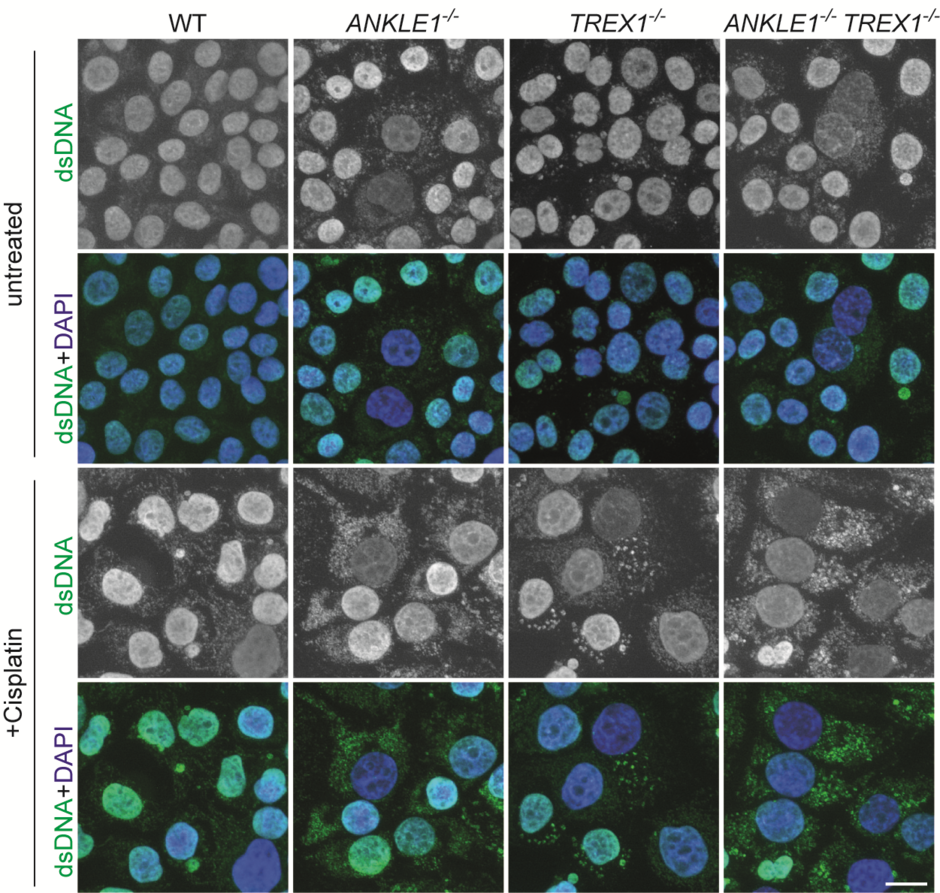 Knockout of ANKLE1 induces excessive accumulation of cytosolic DNA, leading to activation of immune responses. Image credit: Dr Gary Ying Wai CHAN and Dr Huadong JIANG