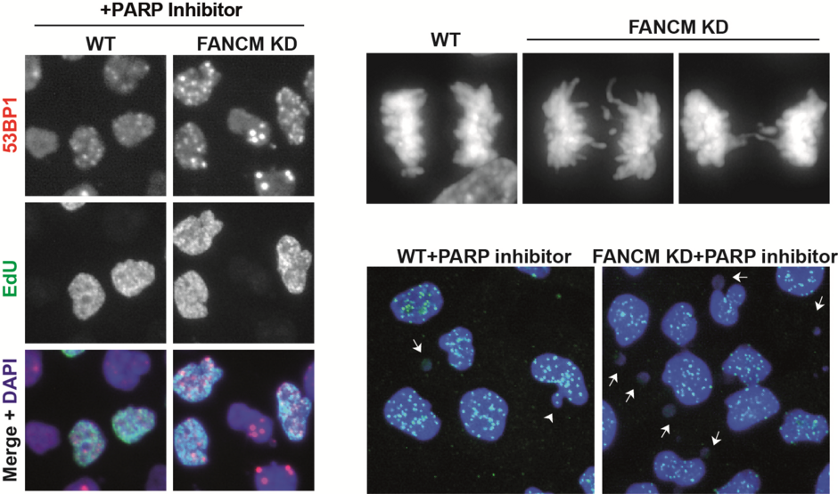Inactivation of a DNA repair gene called FANCM enhances the formation of DNA damage and chromosomal instability induced by a PARP inhibitor, leading to massive cancer cell death. Image modified from Liu et al, Cell Reports (2024).