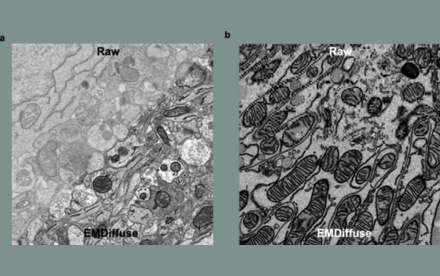 HKU Scientists Develop AI-Driven Method to Enhance Electron Microscopy Imaging Capabilities of Complex Biological Systems