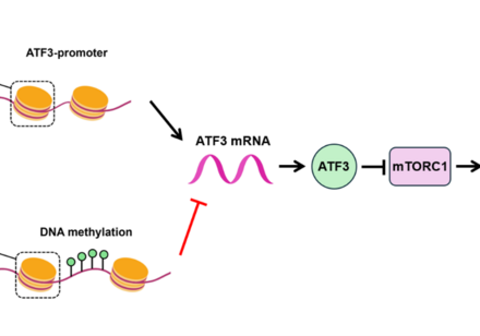 HKU Biologists Uncover How a Genetic Player Fuels Liver Cancer by Disrupting Fat Metabolism