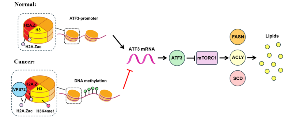 Mechanism of how genetic player VPS72 impacts liver cancer. Too much VPS72 in cells activates the cancer-promoting pathway, which increases fat production and helps liver cancer grow. This study shows a new connection between fat buildup and liver cancer,