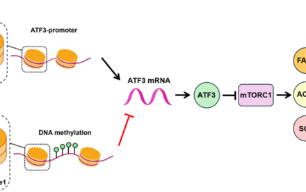 HKU Biologists Uncover How a Genetic Player Fuels Liver Cancer by Disrupting Fat Metabolism
