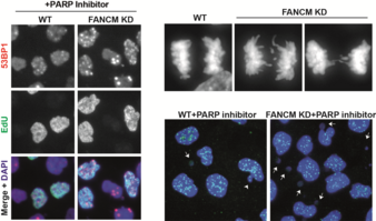 Inactivation of a DNA repair gene called FANCM enhances the formation of DNA damage and chromosomal instability induced by a PARP inhibitor, leading to massive cancer cell death. Image modified from Liu et al, Cell Reports (2024).