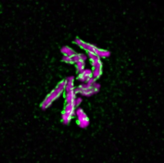 high resolution chromosomes (magenta) and centromere (green) staining image