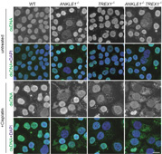 Sky News: Biologists reveal a scissor enzyme that cuts the chromatin bridge and prevents DNA damage and autoimmunity