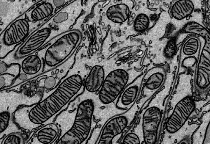AI-Powered Tool RevolutioniSes Electron Microscopy for Cellular Imaging