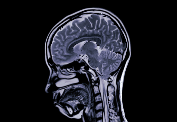Statistical Machine Learning for Medical Imaging Analysis